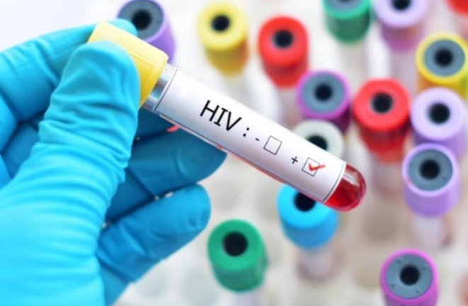Nhiễm HIV làm tăng nguy cơ mắc COVID-19 nghiêm trọng: WHO cảnh báo