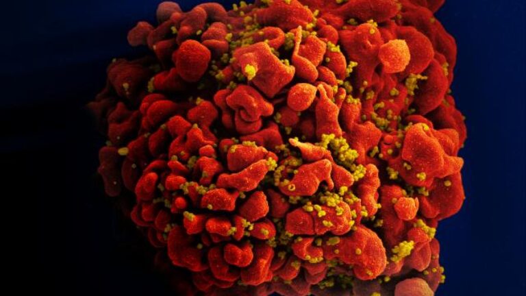 Mỹ phát triển phương pháp 'tiêu diệt' HIV tiềm ẩn trong tế bào