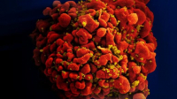 Mỹ phát triển phương pháp 'tiêu diệt' HIV tiềm ẩn trong tế bào