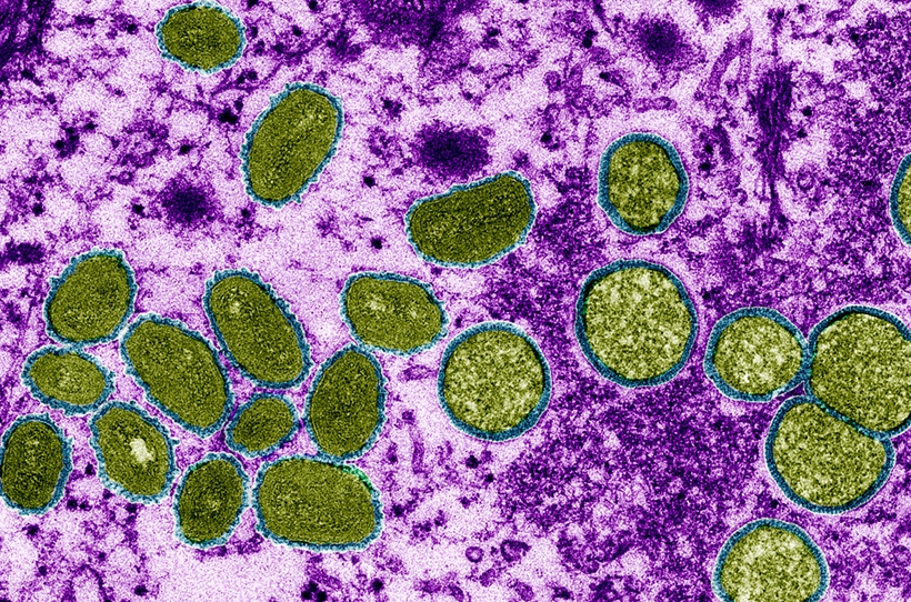 Bệnh đậu mùa khỉ có khả năng dự phòng bằng vaccine đậu mùa không?