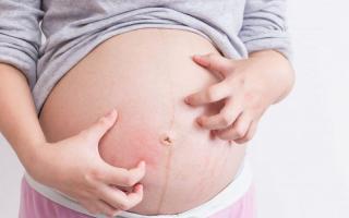  Đang mang bầu có được bôi thuốc ngoài da không?