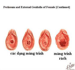 Làm thế nào để kiểm tra ''trinh tiết'' của bạn gái?