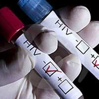 Quan niệm sai lầm về nhiễm HIV