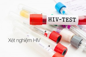 Thời điểm hợp lý để kiểm tra lây nhiễm HIV