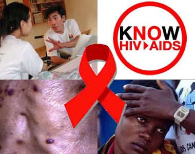 Dấu hiệu nhận biết mình bị nhiễm HIV