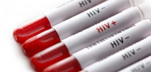 Em cần kiểm tra lại tình trạng lây nhiễm HIV