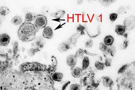 Virus cổ xưa có "họ hàng với HIV" đột nhiên trỗi dậy