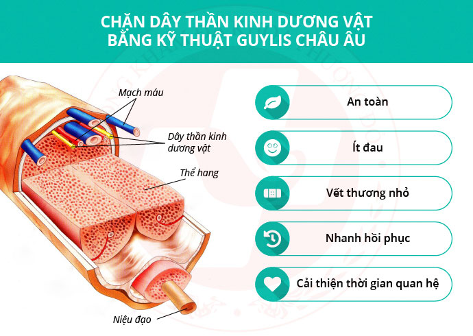 Kỹ thuật chặn dây thần kinh lưng dương vật