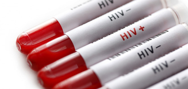 Phát hiện cơ chế giúp chữa khỏi HIV ngay trong não người