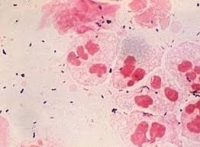 Chlamydia gây bệnh mắt hột