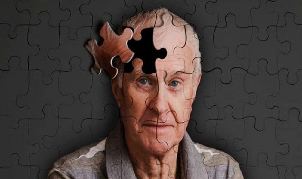 Alzheimer và những dấu hiệu sớm cần lưu ý