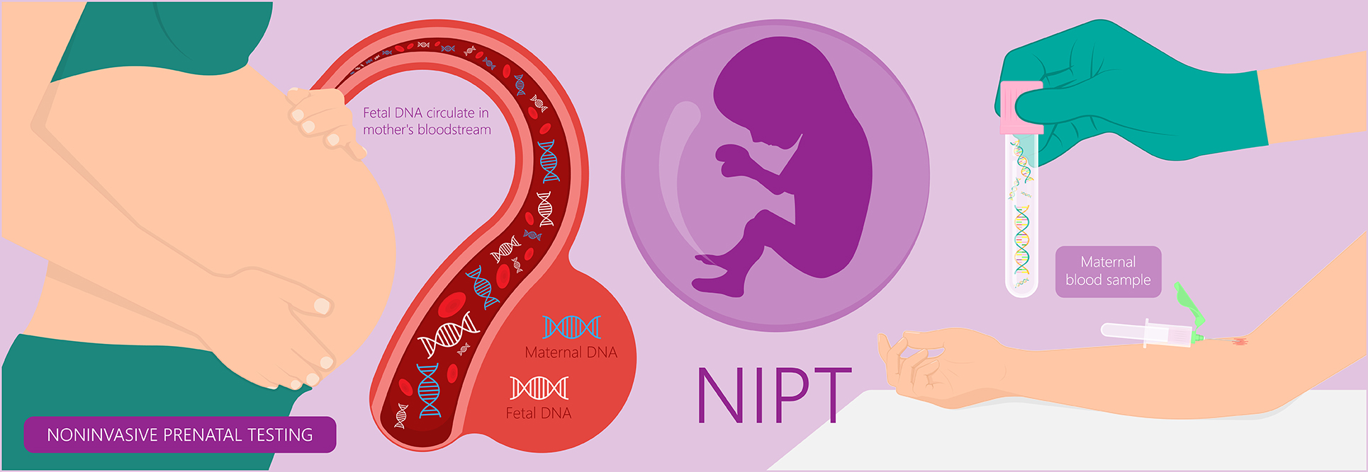 Những điều cơ bản về xét nghiệm NIPT cho mẹ bầu