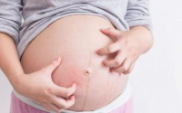  Đang mang bầu có được bôi thuốc ngoài da không?
