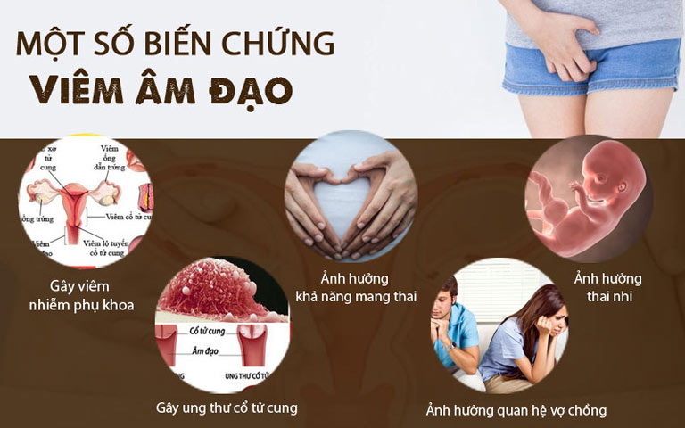 3 biến chứng viêm phụ khoa vào mùa hè mà bạn cần biết !