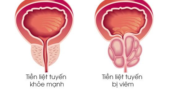 Điều gì xảy ra khi bạn không quan hệ tình dục?