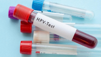 NGƯỜI CHƯA QUAN HỆ CÓ BỊ NHIỄM HPV KHÔNG?