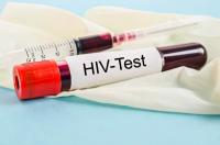 Dấu hiệu HIV ở nam: Phát hiện sớm tăng cơ hội điều trị