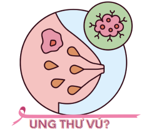 Tìm hiểu về UNG THƯ VÚ – Phần 1