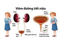 Nhiễm trùng đường tiết niệu ở phụ nữ