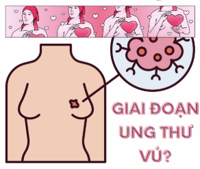 Tìm hiểu về UNG THƯ VÚ – Phần 2