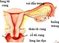 Bạn biết gì về chụp tử cung vòi trứng?