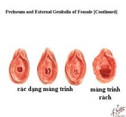 Những chiếc màng trinh ''kì cục''